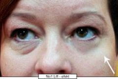 di ANGELO cosmetics Revolučný očný krém s okamžitým efektom No.1 Lift (Eye Cream) 15 ml