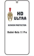 HD Ultra Fólia Xiaomi Redmi Note 11 Pro 75839