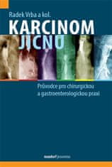 Karcinóm pažeráka - Sprievodca pre chirurgickú a gastroenterologickú prax