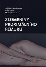 Zlomeniny proximálnej femúru