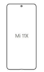 emobilshop Hydrogel - Privacy Anti-Spy ochranná fólia - Xiaomi Mi 11X