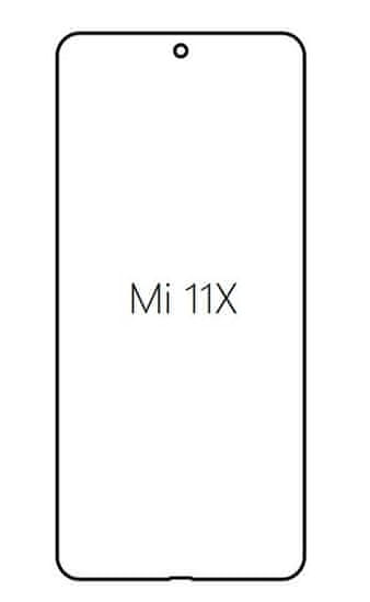 emobilshop Hydrogel - Privacy Anti-Spy ochranná fólia - Xiaomi Mi 11X