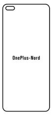 emobilshop Hydrogel - ochranná fólia - OnePlus Nord
