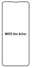 emobilshop Hydrogel - ochranná fólia - Motorola One Action
