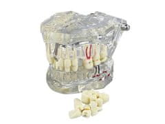 Verk 01964_B Model zubných implantátov biela