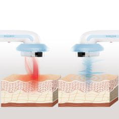 InnovaGoods Ultrazvukový kavitačný anticelulitídny masážny prístroj 3 v 1 s infračervenou a elektrostimuláciou CellyMax InnovaGoods 