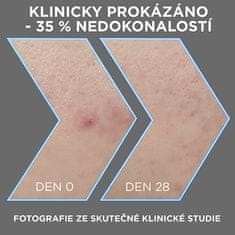 Sérum proti nedokonalostiam pleti AHA + BHA Charcoal (Serum) 30 ml