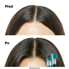 Loreal Professionnel Šampón pre citlivú pokožku hlavy Scalp Advanced Anti-Discomfort Dermo (Regulator Shampoo) (Objem 300 ml)