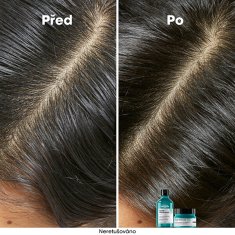 Loreal Professionnel Čistiaci šampón pre mastnú pokožku hlavy Scalp Advanced (Anti Oiliness Dermo Purifier Shampoo) (Objem 500 ml)