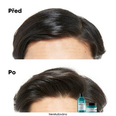 Loreal Professionnel Šampón a maska pre mastnú pokožku hlavy 2 v 1 Scalp Advanced (Anti-Oiliness 2-in-1 Clay) 250 ml