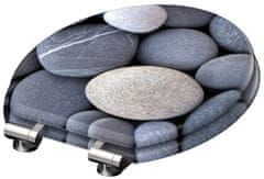 Eisl WC sedadlo Grey stones MDF so spomaľovacím mechanizmom SOFT-CLOSE