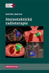 David Feltl: Stereotaktická radioterapie