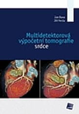 Jan Baxa: Multidetektorová výpočetní tomografie srdce