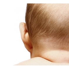 Otostick OTOSTICK Baby Korektor odstávajúcich uší pre deti 8 ks