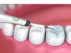 Sobex Ultrazvukový skener zubného kameňa
