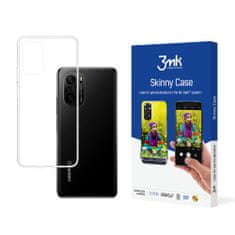 3MK Skinny puzdro pre Xiaomi Mi 11X Pro - Transparentná KP20151