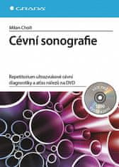 Milan Cholt: Cévní sonografie - repetitorium ultrazvukové cévní diagnostiky a atlas nálezů na DVD