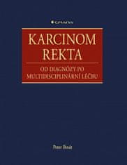 Peter Ihnát: Karcinom rekta - Od diagnózy po multidisciplinární léčbu