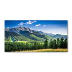 Wallmuralia.sk Foto obraz akryl do obývačky Skokanský mostík Tatry 125x50 cm 2 prívesky