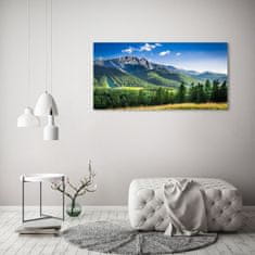 Wallmuralia.sk Foto obraz akryl do obývačky Skokanský mostík Tatry 125x50 cm 2 prívesky