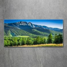 Wallmuralia.sk Foto obraz akryl zvislý do obývačky Skokanský mostík Tatry 100x70 cm 2 prívesky