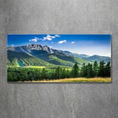 Wallmuralia.sk Foto obraz akryl do obývačky Skokanský mostík Tatry 125x50 cm 2 prívesky