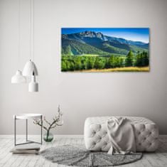 Wallmuralia.sk Foto obraz akryl zvislý do obývačky Skokanský mostík Tatry 100x70 cm 2 prívesky