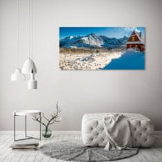 Wallmuralia.sk Foto obraz akrylový Domček v horách 140x70 cm 2 prívesky