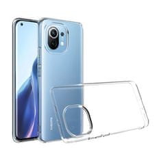 FORCELL Silikónové puzdro 2mm pre Xiaomi redmi note 11 / 11S transparentné