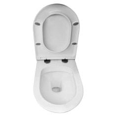 Mereo WC závesné, RIMLESS, 530x355x360, keramické, vrátane sedátka CSS113S VSD81S - Mereo